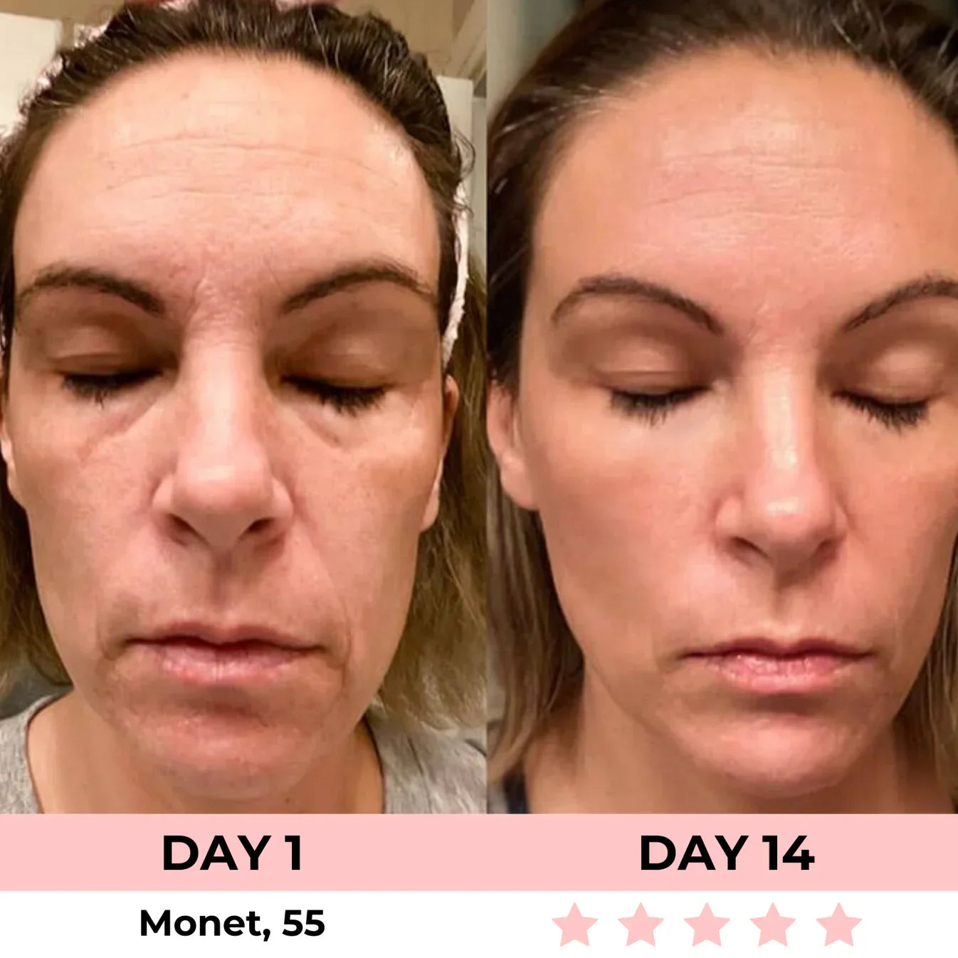 60% OFF + FREE SHIPPING🔥CYBER MONDAY SALE ENDS TONIGHT💝AURORA 7-in-1 LED Facial Sculptor