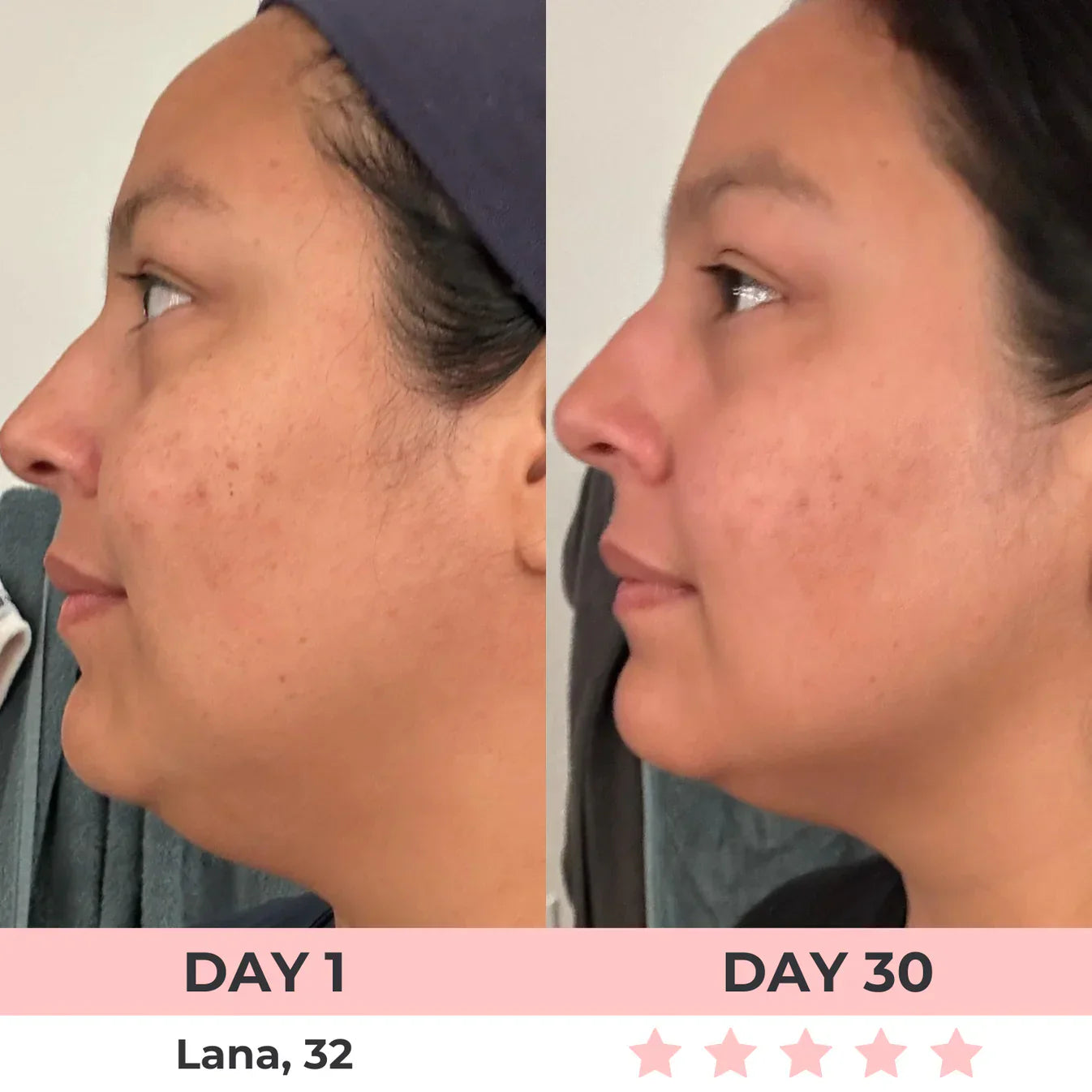 60% OFF + FREE SHIPPING🔥CYBER MONDAY SALE ENDS TONIGHT💝AURORA 7-in-1 LED Facial Sculptor